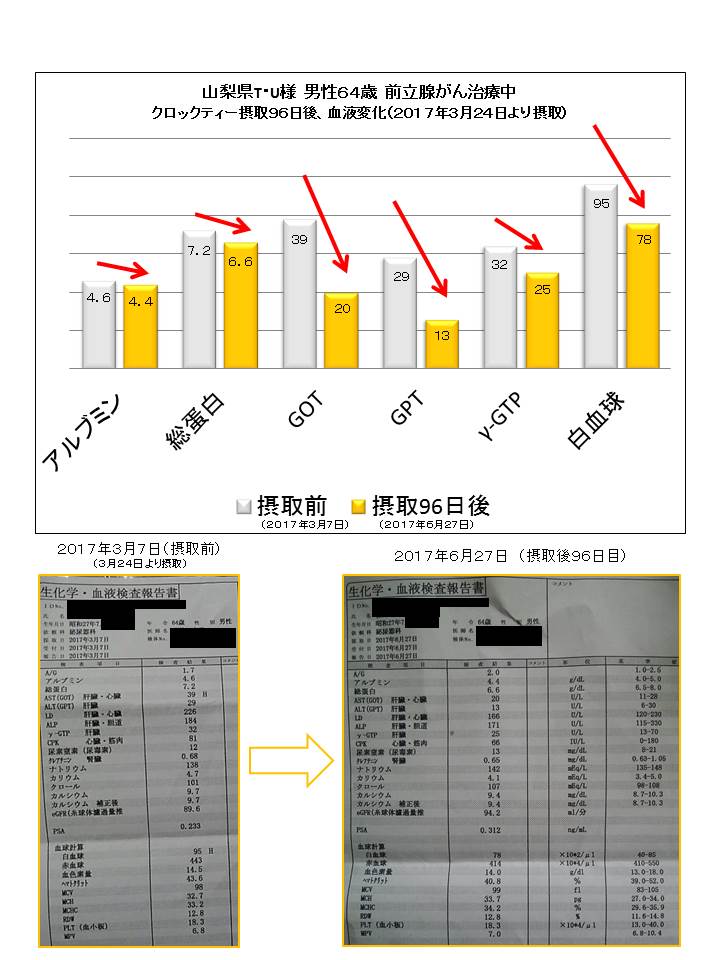 山梨県　男性　６４歳　クロックティー摂取後変化