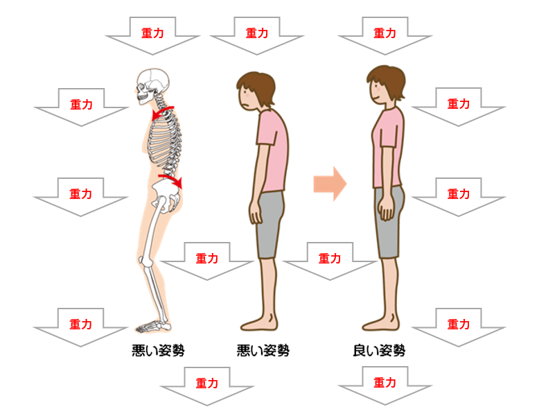 重力における悪い姿勢比較（抗重力筋）