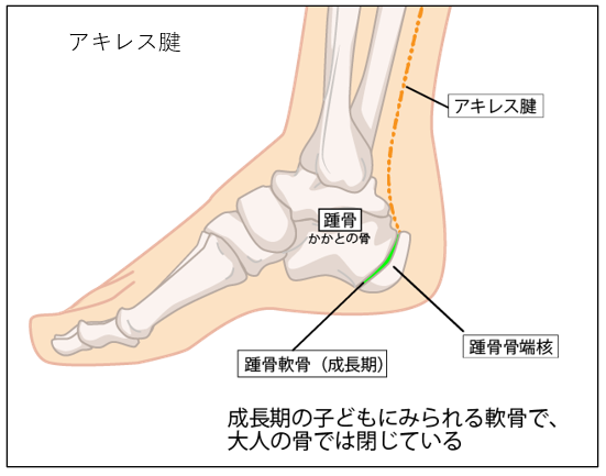 アスリートに多いアキレス腱の痛み アキレス腱炎と足趾把持力 足指握力 との関係についての考察 腸内環境株式会社