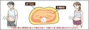 下腹ぽっこりの理由は、弓状線の緩み（腹横筋の衰え）、そして腹圧の低下、内臓の下垂などがあげられます。