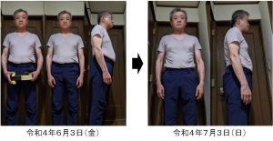 東京都　男性　６２歳　ワシーガスタイル使用変化　ビフォー・アフター　１ヶ月経過