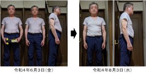 東京都　男性　６２歳　ワシーガスタイル使用変化　ビフォー・アフター　２ヶ月経過