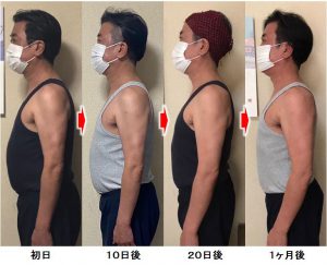 東京都　男性　５３歳 令和４年６月２０日（月）スタート ワシーガスタイル使用　ビフォー・アフター　１ヶ月経過