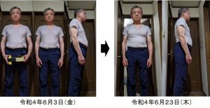 東京都　男性　６２歳　ワシーガスタイル使用変化　ビフォー・アフター　２０日経過