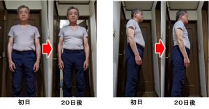 東京都　男性　６２歳　ワシーガスタイル使用変化　ビフォー・アフター　２０日経過