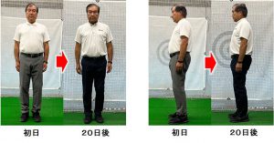 東京都　男性　７０歳 ワシーガスタイル使用変化　ビフォー・アフター　２０日経過