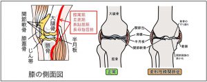 膝内部 温故知新ラボ変形性膝関節症エクササイズ