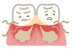 歯周病