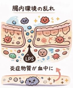腸内環境の乱れ